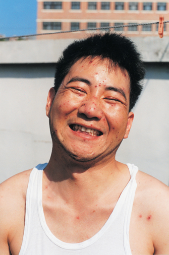B 1 1 Chicken pox friendly jpg
