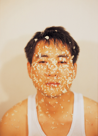B 2 miss you chicken pox jpg